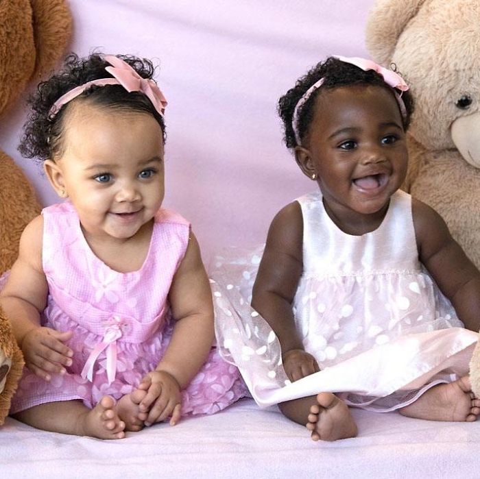 Twins Born With Different Color Skintones Win Over Our ...